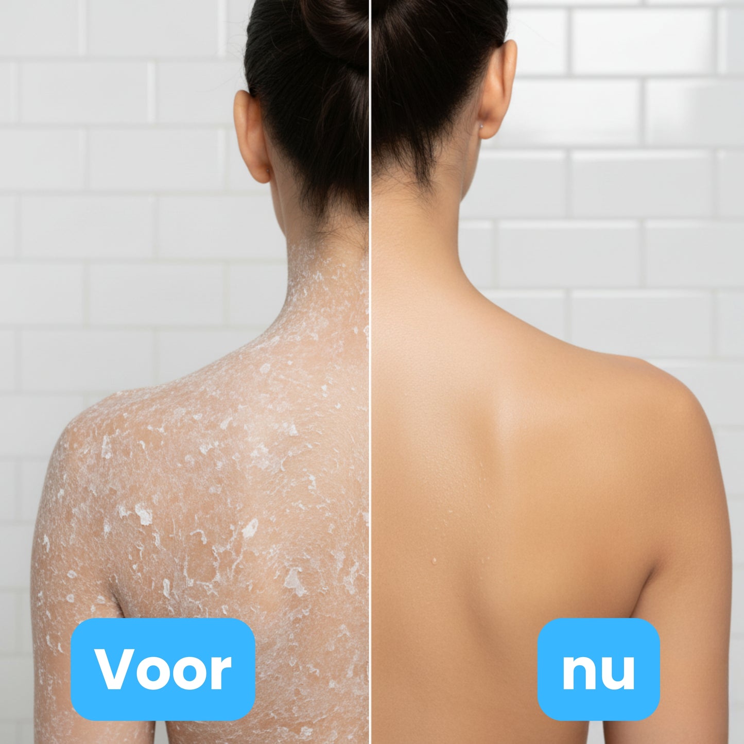 SKINOVA - Nieuwe Huid, Nieuwe Jij